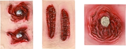 Self-adhesive scars - 1 piece